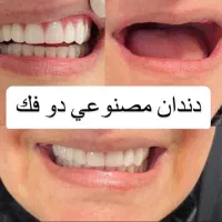دندانساری متحرک(مصنوعی)|خدمات آرایشگری و زیبایی|اصفهان, جاوان|دیوار