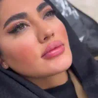 تزریق فیلر لب،گونه،زیرچشم چانه طبیعی و بدون درد