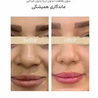 کرم کوچیک کننده بینی|آرایشی، بهداشتی، درمانی|قرقری, |دیوار