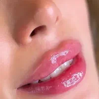تزریق ژل لب روسی/مزو / آنزیم