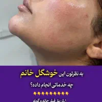ژل لب،بوتاکس،زاویه سازی توسط پزشک|خدمات آرایشگری و زیبایی|تهران, صادقیه|دیوار