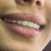 جشنواره پاییزه دندانپزشکی|خدمات آرایشگری و زیبایی|قم, آزادگان|دیوار