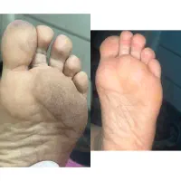 پاکسازی صورت/موژه/پدیکورپا(اموزش هم داده‌میشود)|خدمات آرایشگری و زیبایی|اهواز, شهرک رزمندگان|دیوار