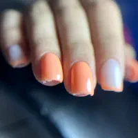 کاشت ،ترمیم،لمینت