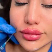 خدمات بوتاکس و زیبایی (جشنواره ویژه روز شنبه)