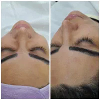 خدمات تخصصی پاکسازی و فیشیال پوست|خدمات آرایشگری و زیبایی|کرج, آق تپه|دیوار