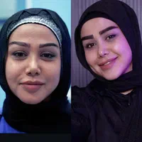 کاشت مو و ابرو و ریش بدون جراحی تراکم بالا|خدمات آرایشگری و زیبایی|تهران, الهیه|دیوار