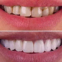 درمانگاه دندانپزشکی خاورمیانه/طرف قراردادبابیمه ها|خدمات زیبایی و سلامت|شیراز, عفیفآباد|دیوار