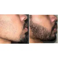 ریش میخوای بیا پیش خدم