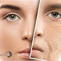 جشنواره بلک فرایندی بوتاکس، لیزر وجراحی و جوانسازی