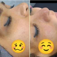 فیشال تخصصی/پلاژن تراپی/کربوکسی /پارافین تراپی|خدمات آرایشگری و زیبایی|کرمان, |دیوار