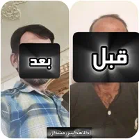 کلاه گیس مردانه زنانه الیافی و طبیعی مشهد و تهران