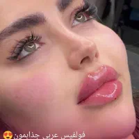 تزریق ژل و بوتاکس|خدمات آرایشگری و زیبایی|اردبیل, |دیوار