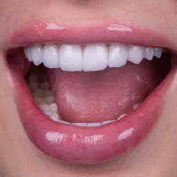 دندانپزشکی|خدمات آرایشگری و زیبایی|کوهدشت, |دیوار