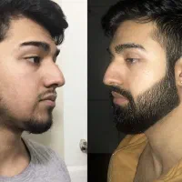وقتشه ریشت پرپشت بشه