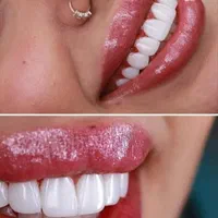 دندانپزشکی اقساطی عصب کشی . کامپوزیت و...|خدمات آرایشگری و زیبایی|قم, عمار یاسر|دیوار