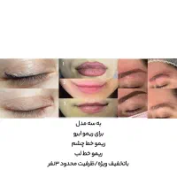 پاک کردن تتو در یک جلسه