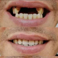 لابراتوار دندانسازی (دندان مصنوعی)|خدمات آرایشگری و زیبایی|اصفهان, جنیران (لادان)|دیوار