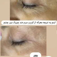 دعوت به مشاوره رایگان|آرایشی، بهداشتی، درمانی|شیراز, ابیوردی|دیوار