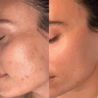 بلک فرایدی فشیال پوست