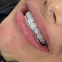 جشنواره دندانپزشکی با اقساط