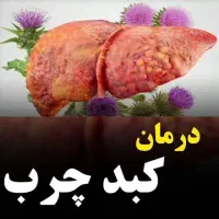مشاوره کبد چرب