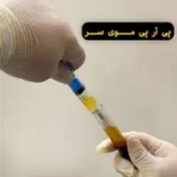 prp پی ارپی مو صورت... مطب دکتر صادقیه|خدمات آرایشگری و زیبایی|تهران, فردوس|دیوار