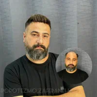 پروتز مو طبیعی vip در اصفهان