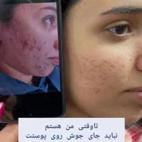 استخدام اموزش پوست بامدرک فنی و حرفه ۷۵درصد تخفیف