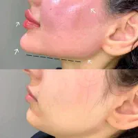 کلینیک زیبایی زکریا  خدمات تخصصی زیبایی|خدمات آرایشگری و زیبایی|مشهد, بهارستان|دیوار