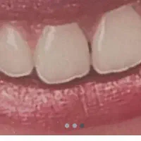 دندان پزشکی