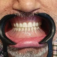 استخدام تکنسین دندانسازی