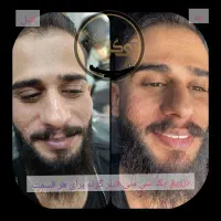 تزریق ژل،بوتاکس،آنزیم،پی آر پی، مزو ژل برای آقایان|خدمات آرایشگری و زیبایی|خرمشهر, |دیوار