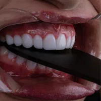 دندانپزشکی کامپوزیت لمینیت ایمپلنت بلیچینگ درمانی|خدمات آرایشگری و زیبایی|مشهد, سجاد شهر|دیوار