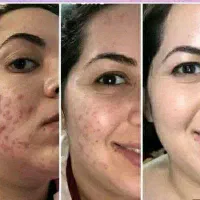 راه حل با طبیعت