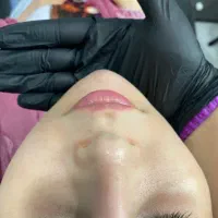 ژل. مزو ژل. جوانساز. بوتاکس|خدمات آرایشگری و زیبایی|کرج, حصارک پایین|دیوار