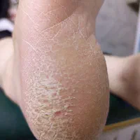 کفسابی و پدیکور پا بصورت تخصصی مخصوص بانوان|خدمات آرایشگری و زیبایی|اسلامشهر, شهرک امام حسین (میان آباد)|دیوار