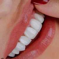 دندانپزشکی ایمپلنت روکش ارتودنسی اقساطی|خدمات آرایشگری و زیبایی|مرند, |دیوار