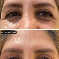 تزریقات زیبایی و خدمات درمانی|خدمات آرایشگری و زیبایی|کرج, دانشگاه آزاد|دیوار