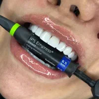 دندانپزشکی.کامپوزیت دندان .عصب کشی .لمینت.روکش