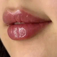 فیلر مزو  بوتاکس prp ژل در مطب زیبایی خانم نامی