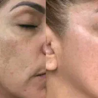از بین برنده لک