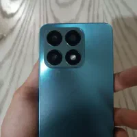 فروش هانر X8a|موبایل|شیروان (خراسان), |دیوار