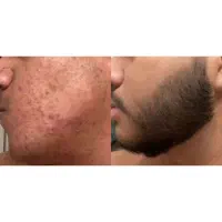 نداری ریش پس بیا باهم پرشت کنیم
