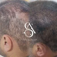 تتوبدن،فیبروزابرو،آرایش دائم،میکرواسکالپ سر،ریمو|خدمات آرایشگری و زیبایی|کرمانشاه, |دیوار