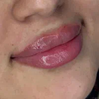 ژل لب روسی زاویه فک گونه چونه فیلرزیرچشم شقیقه نخ|خدمات آرایشگری و زیبایی|تهران, پاسداران|دیوار