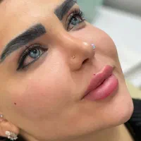 بوتاکس فیلرژل لب گونه چانه زاویه فک و صورت مادلینگ|خدمات آرایشگری و زیبایی|تهران, تهرانپارس غربی|دیوار
