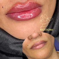 کلنیک زیبایی  لیزر تتو بدن، تزریق ژل و بوتاکس و...|خدمات آرایشگری و زیبایی|اسلام‌شهر, شهرک واوان|دیوار
