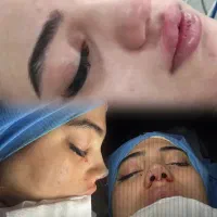 جراحی بینی صورت و بدن
