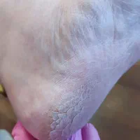 پدیکور حرفه ای پا vip